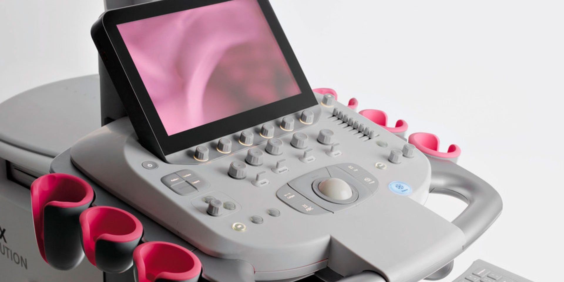 nhap-khau-may-sieu-am-ve-vietnam